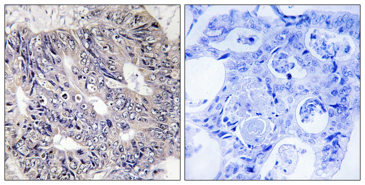 EPS8L1 Antibody (aa411-460)
