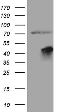 FBXO25 Antibody (aa1-191, clone OTI1A1)