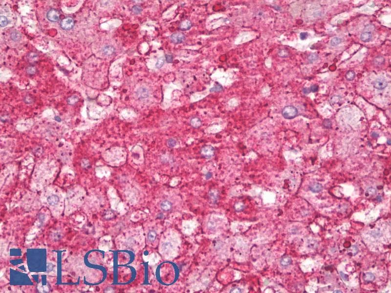 IHC-plus™ ANXA6/Annexin A6/Annexin VI Antibody (aa1-50)