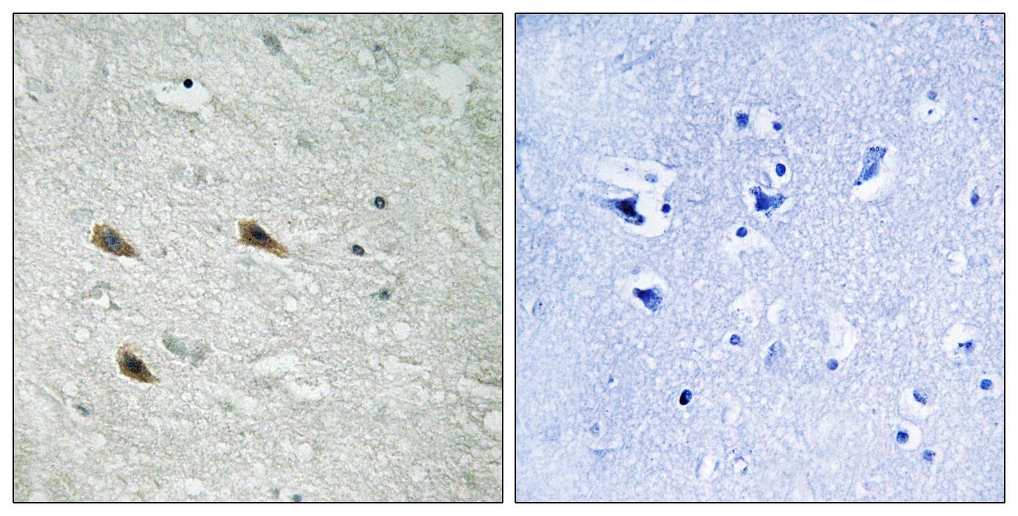 RAF1 / RAF Antibody (phospho-Ser289)