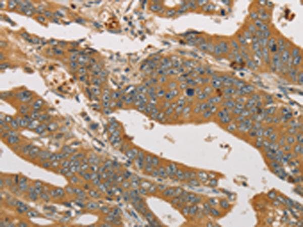 Polyclonal Rabbit anti-Human XPR1 Antibody (IHC)
