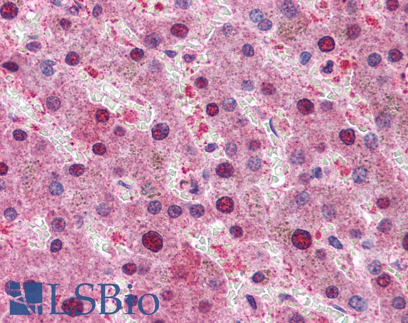 IHC-plus™ Polyclonal Goat anti-Human RPS6KB1 / P70S6K / S6K Antibody (aa490-502, IHC, WB)