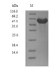 Human DYRK2 Protein (Recombinant 6His, N-terminus)