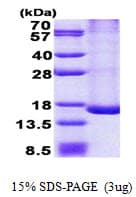 Human HSPC176 / TRAPPC2L Protein (Recombinant His)