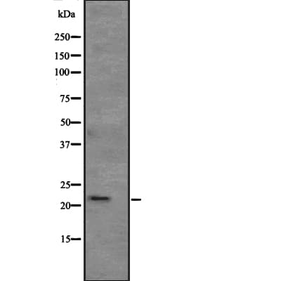 Polyclonal Rabbit anti-Human ATRAID / C2orf28 Antibody (IHC, WB)