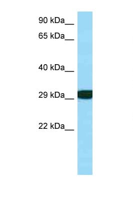 Polyclonal Rabbit anti-Human RPS3 / Ribosomal Protein S3 Antibody (C-Terminus, WB)