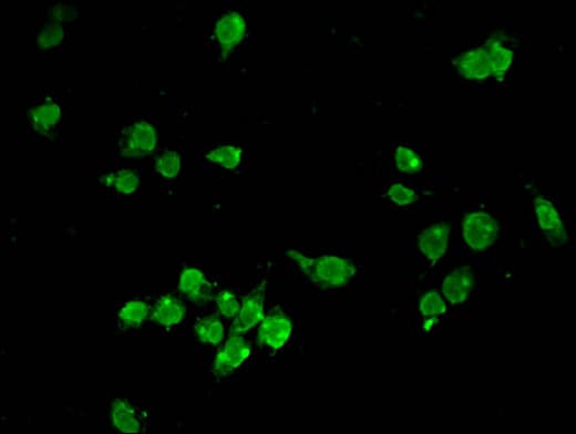 HMG2 / HMGB2 Antibody