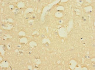 WBSCR17 Antibody