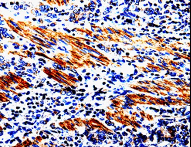 Polyclonal Rabbit anti-Human ACSBG2 Antibody (IHC)