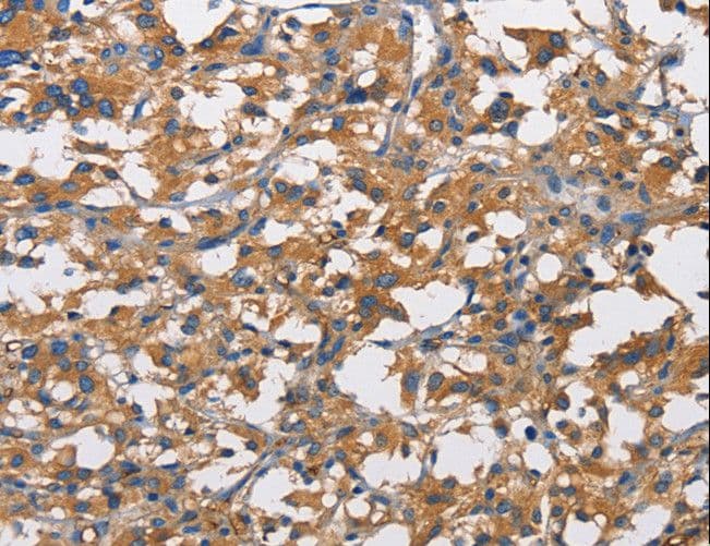NT5E / eNT / CD73 Antibody