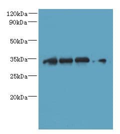 Polyclonal Rabbit anti-Human DNAJC17 Antibody (IHC, WB)
