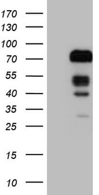 FOXO4 / AFX1 Antibody (aa206-505, clone OTI1A4)