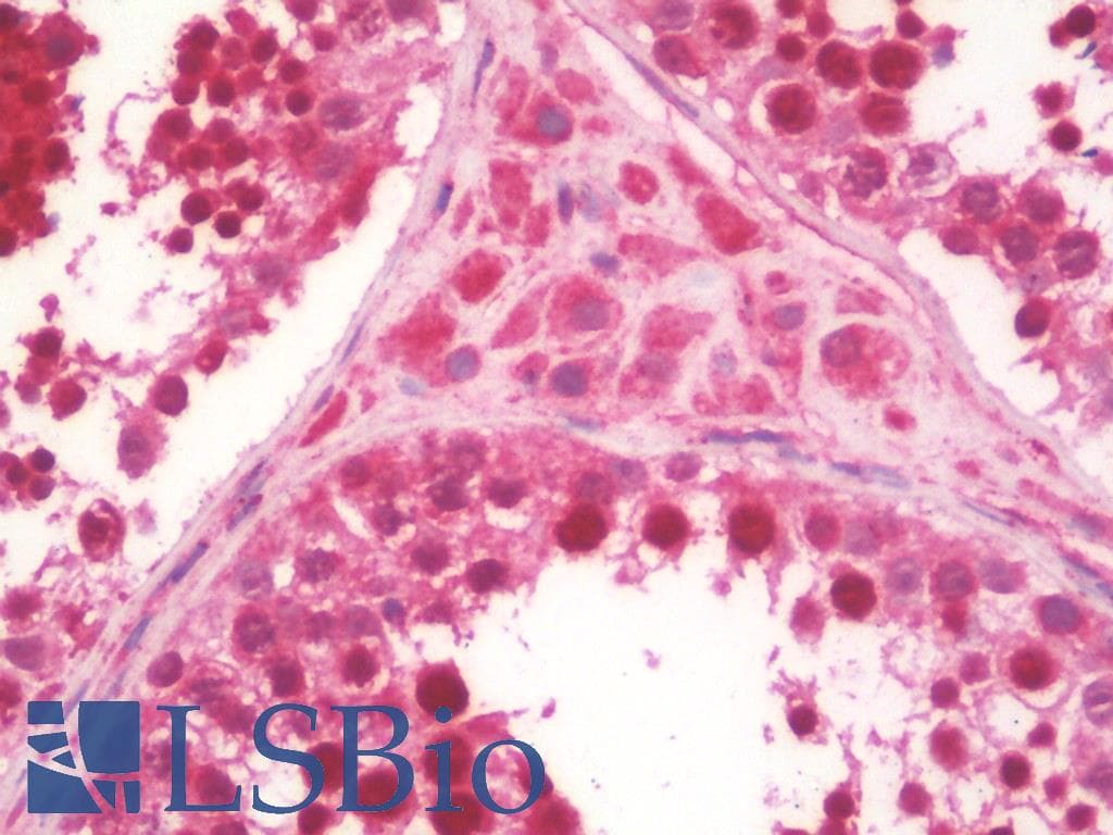 IHC-plus™ CTG-B45d / THAP11 Antibody