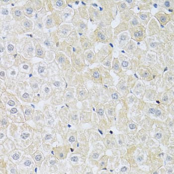 SLC4A5 / NBC4 Antibody