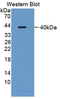 FMR1 / FMRP Antibody (aa1-314, FITC)
