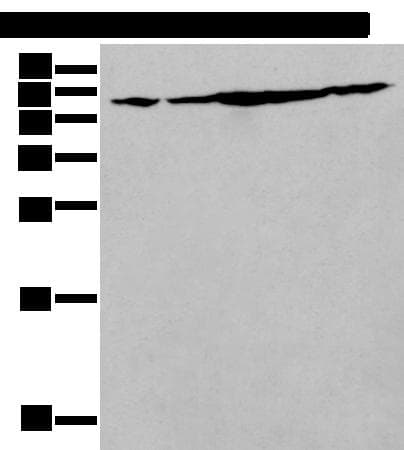 Polyclonal Rabbit anti-Human IRF5 Antibody (IHC, WB)