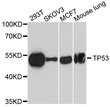 Monoclonal Mouse anti-Human TP53 / p53 Antibody (WB)
