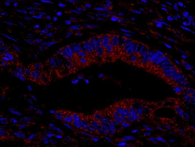 KIAA1524 / p90 Autoantigen Antibody (aa550-600)