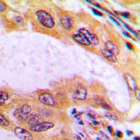 Polyclonal Rabbit anti-Human B4GALT3 Antibody (Internal, IHC, WB)