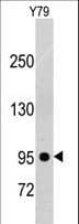 PDGFRB / PDGFR Beta Antibody