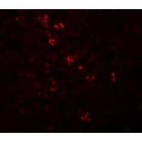 PD-L2 / PDCD1LG2 / CD273 Antibody