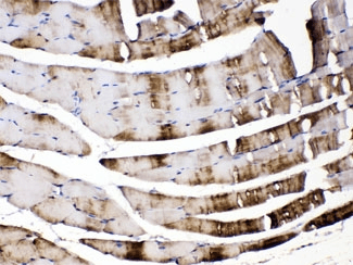 Polyclonal Rabbit anti-Human CA3 / Carbonic Anhydrase III Antibody (IHC, WB)