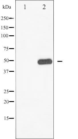 BLNK Antibody (phospho-Tyr96)