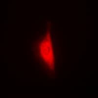 WBSCR22 Antibody