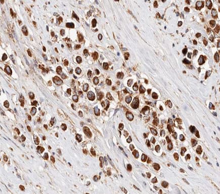 Polyclonal Rabbit anti-Human IRX2 Antibody (IHC, IF, WB)