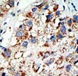 Polyclonal Rabbit anti-Human SAE2 / UBA2 Antibody (aa601-631, IHC, WB)