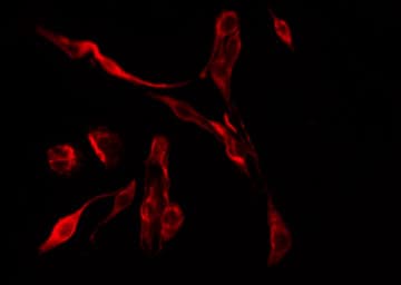 Polyclonal Rabbit anti-Human CLIC6 Antibody (IF, WB)