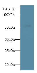 Polyclonal Rabbit anti-Human L2HGDH Antibody (IHC, WB)