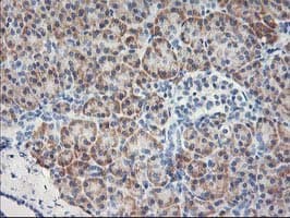 MTFMT Antibody (aa175-389, clone OTI1C1)