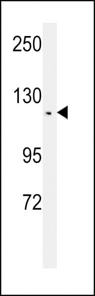 IHC-plus™ TSHZ2 Antibody (aa232-261)