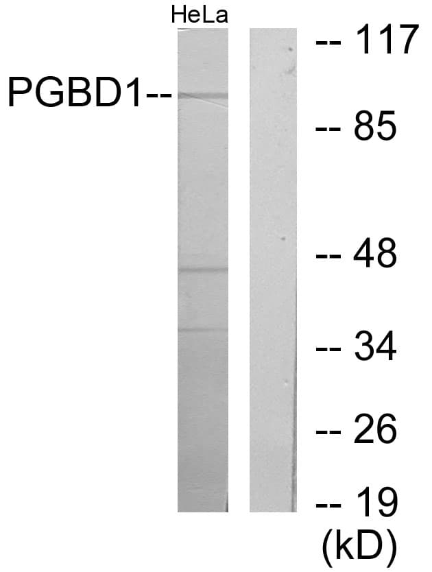 Polyclonal Rabbit anti-Human PGBD1 Antibody (aa241-290, WB)