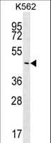 Polyclonal Rabbit anti-Human PLCXD2 Antibody (aa99-127, IHC, WB)