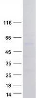 Human PAX3 Protein (Recombinant Myc-DDK (Flag))