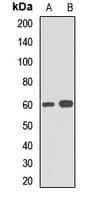 SQSTM1 Antibody