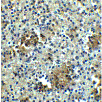 ABCA1 Antibody