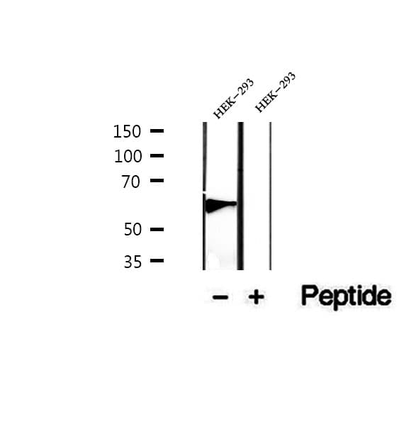JADE1 / PHF17 Antibody