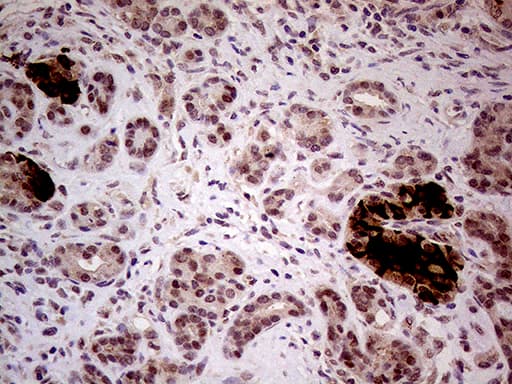 INPP5F Antibody (clone OTI1D4)