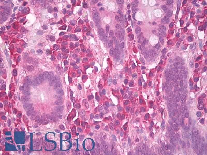 IHC-plus™ MNK / ATP7A Antibody (clone S60-4)