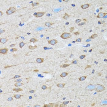 Polyclonal Rabbit anti-Human CLDN11 / Claudin 11 Antibody (IHC, IF, WB)