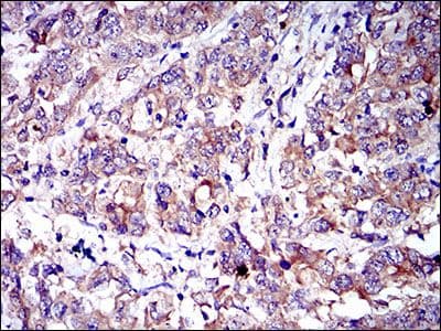 CD6 Antibody (Amino Acid: 472-668, clone 6B9)