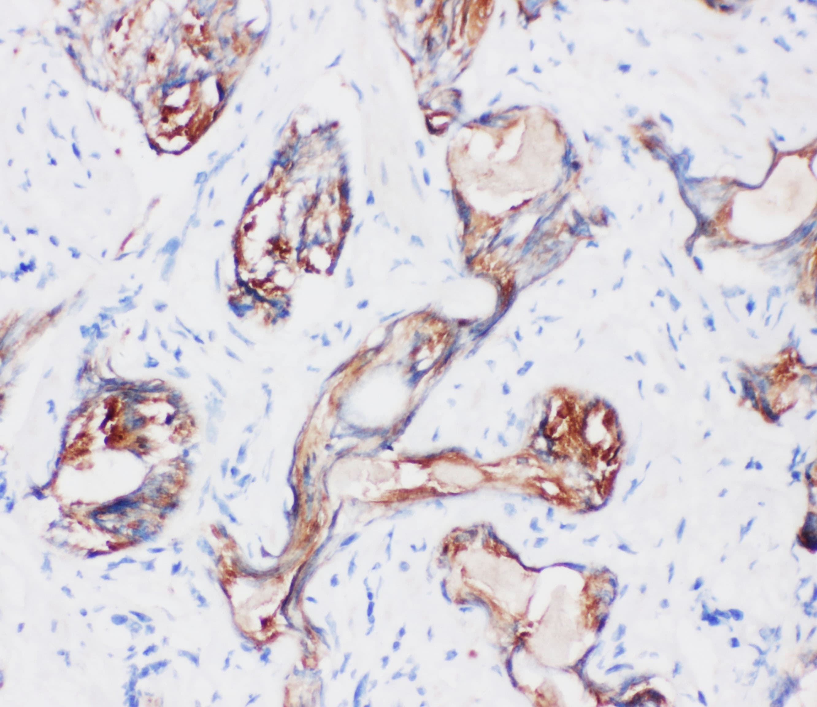 Polyclonal Rabbit anti-Human KLK2 / Kallikrein 2 Antibody (aa243-261, IHC, WB)