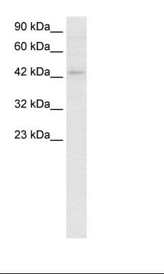 LEF1 Antibody (aa282-331)