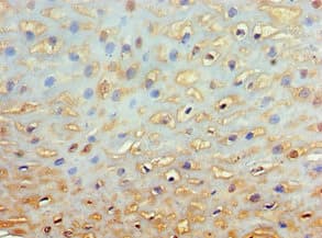 Polyclonal Rabbit anti-Human GRB7 Antibody (aa233-532, IHC)