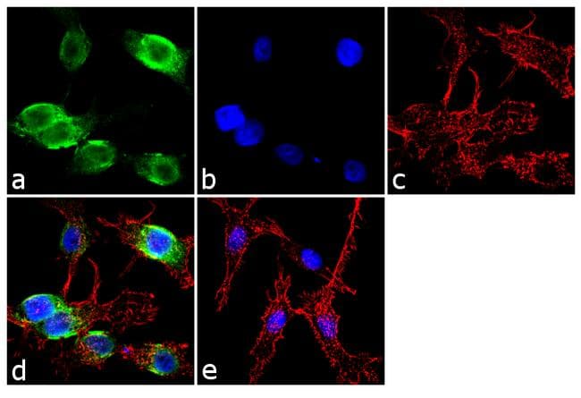 CRP / C-Reactive Protein Antibody (clone P4D7)