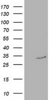 RTFDC1 Antibody (clone OTI3A5)