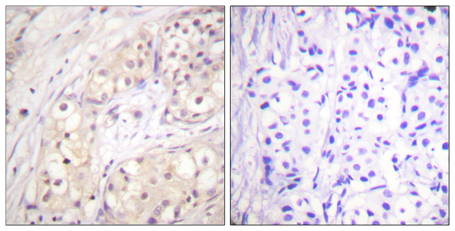 BRAF / B-Raf Antibody (aa571-620)